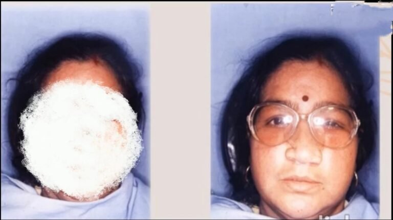 लाखों-करोड़ों नहीं, यहां सिर्फ 500 रुपये में लगता आर्टिफिशियल अंग, हर साल 50 से अधिक मरीजों की लौट रही मुस्कान